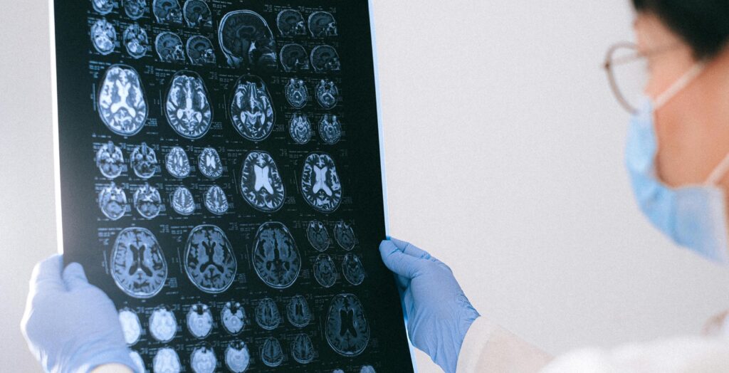 doctor looking at brain scans representing Brain trauma and alcohol